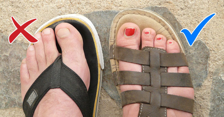 5 Alarming Reasons Why You Should Never Ever Wear Flip-Flops Again - Featured image