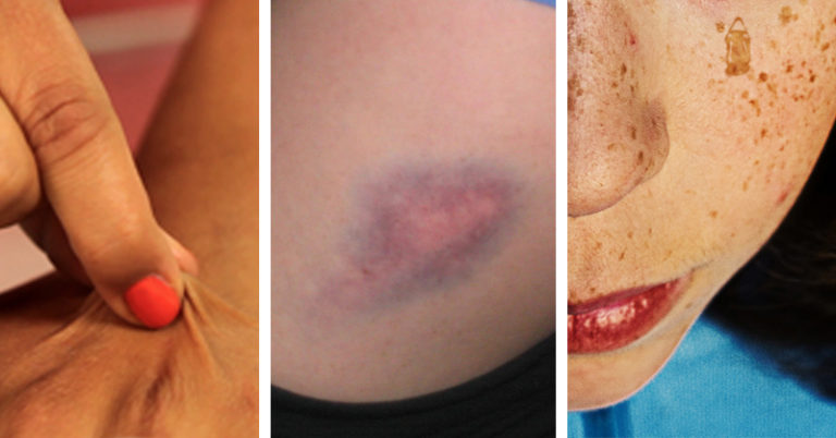 5 Minor Signs That Something is Majorly Wrong With Your Body - Featured image