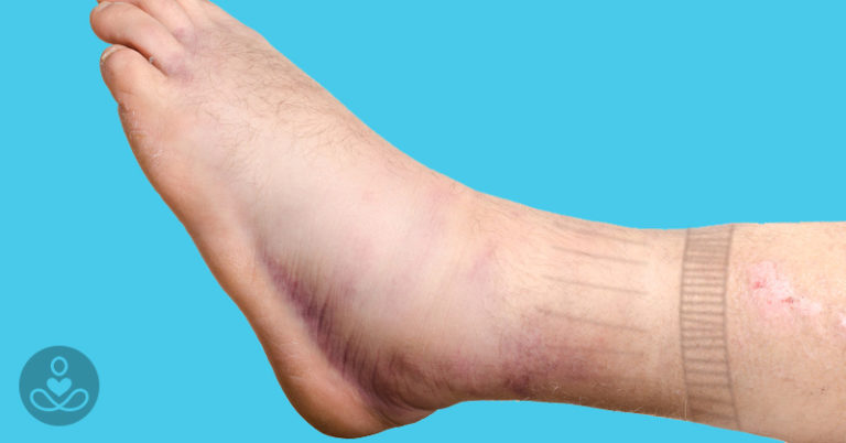 11 Strange And Surprising Signs Of Heart Disease You Need To Know About - Featured image