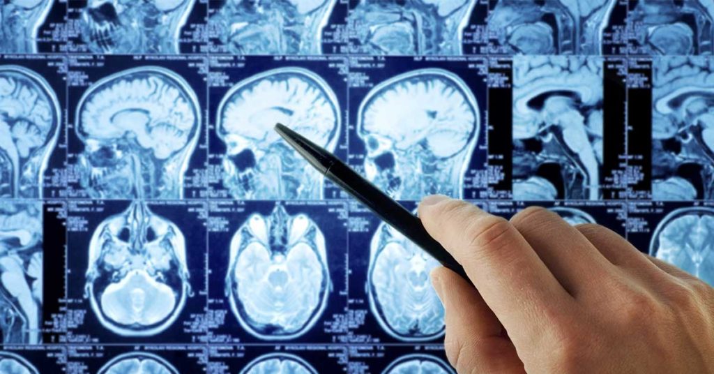 Belgian boy, 13, is the first person in the world to be cured of extremely deadly brain cancer - Featured image