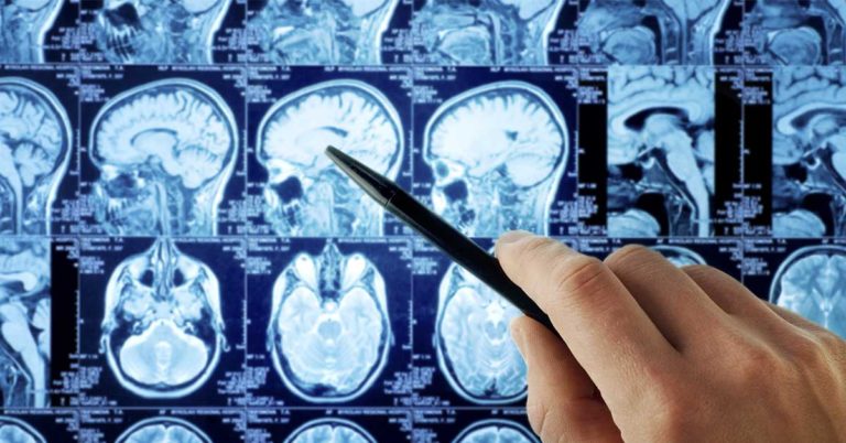 Belgian boy, 13, is the first person in the world to be cured of extremely deadly brain cancer - Featured image