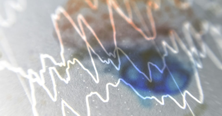 First Scan of the Dying Brain Reveals a “Last Recall” - Featured image