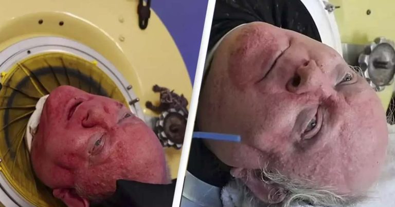 Man Who Live in Iron Lung Since for Over 70 Years Dies at 78 - Featured image