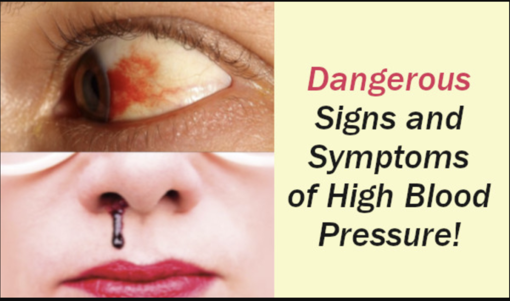 9 Dangerous Signs and Symptoms of High Blood Pressure that you should not Ignore - Featured image