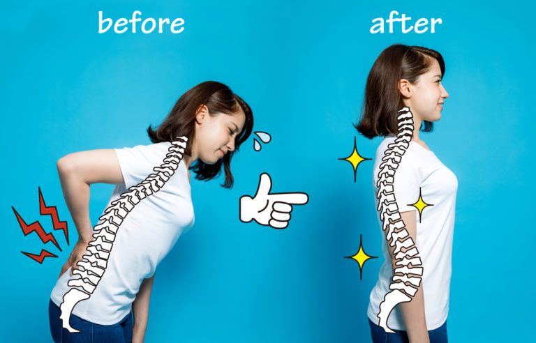 How to Fix the 4 Most Common Posture Problems - Featured image